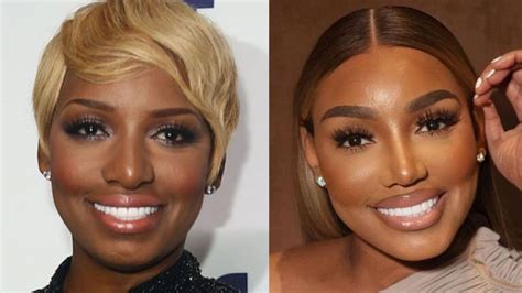 nene leaks before surgery|Inside ‘RHOA’ Alum NeNe Leakes Plastic Surgery Procedures